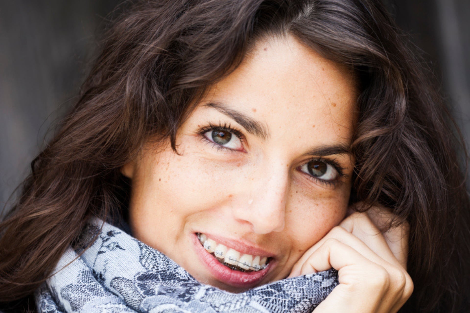 Can You Get Braces the Same Day as Your Consultation in Middletown, DE? Honig Orthodontics in Newark, DE
